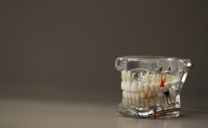 WHAT IS RCT? THERE IS NOTHING TO BE SCARED OF REALLY..!