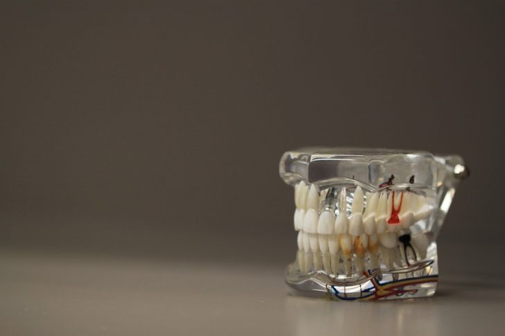 WHAT IS RCT? THERE IS NOTHING TO BE SCARED OF REALLY..!